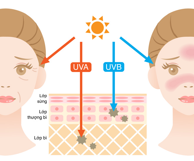 Sắp nóng cao điểm, chuyên gia da liễu nói gì về cách ứng phó tia UV cao làm hại da? - 1