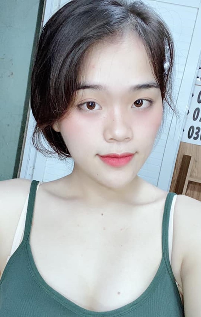 Ngân Thảo: Từ cô gái mất 9 cái răng amp;#34;lột xácamp;#34; thành mỹ nữ gợi cảm - 10