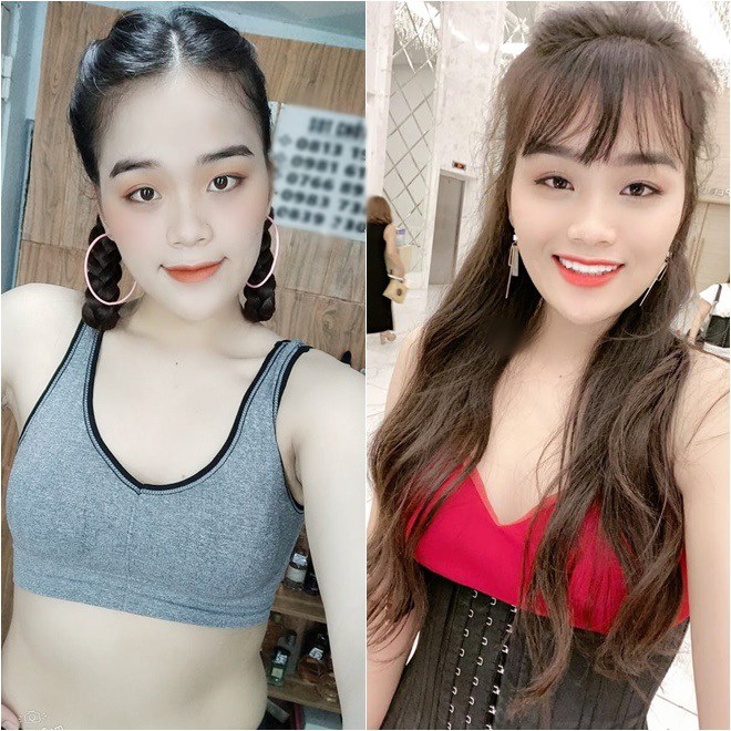 Ngân Thảo: Từ cô gái mất 9 cái răng amp;#34;lột xácamp;#34; thành mỹ nữ gợi cảm - 4