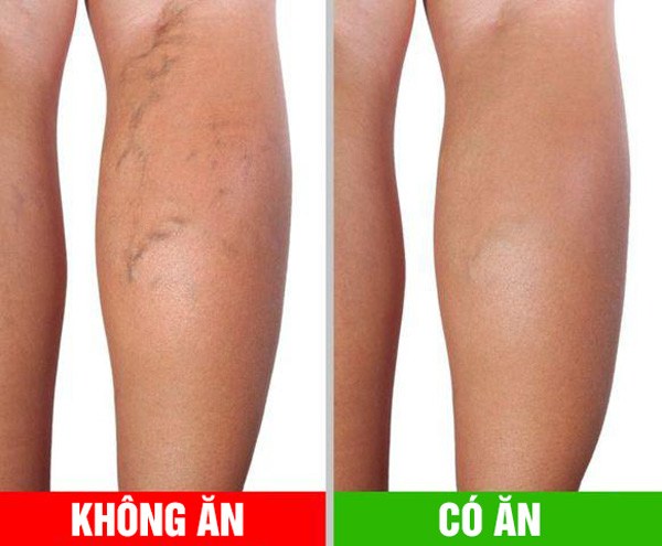 Ăn ớt chuông mỗi ngày thu về 8 lợi ích, nhưng ăn sống hay ăn chín tốt hơn? - 4