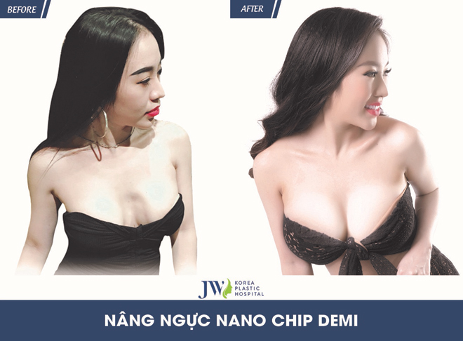 Chuyên gia cảnh báo: Đừng đặt cược tính mạng vì làm đẹp theo cách này! - 3