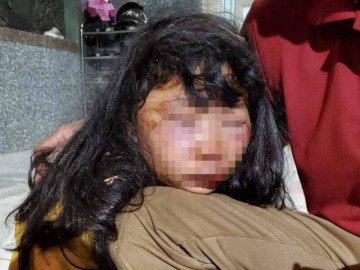 Vụ nữ sinh lớp 6 bị giật tóc, đánh ngất xỉu trong lô cao su: Người thân tiết lộ bất ngờ