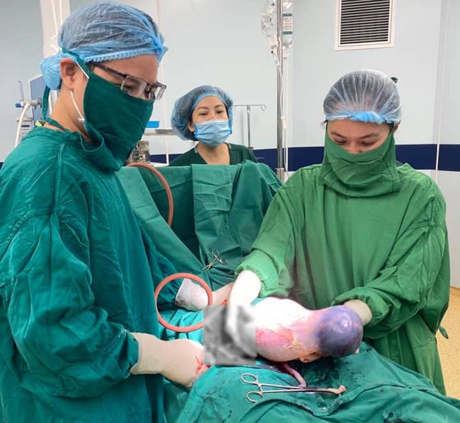 Bất ngờ hình ảnh một em bé song sinh chào đời vẫn còn nguyên trong bọc ối - 1