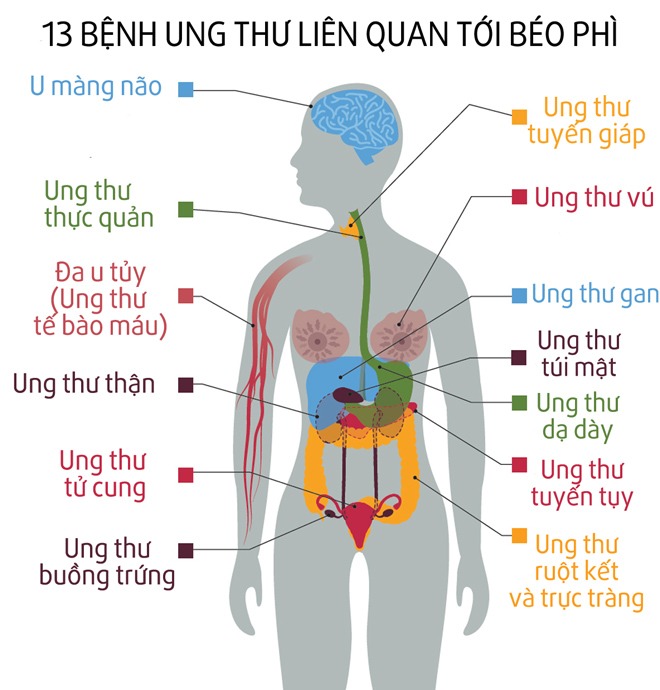 Nếu bạn có đặc điểm này, nguy cơ mắc 13 loại ung thư sẽ tăng lên, cần thay đổi ngay - 2