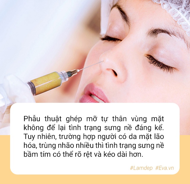Hoa hậu Indonesia hỏng mặt vì phẫu thuật thẩm mỹ, chuyên gia nói gì về trường hợp này? - 7