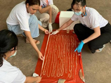 Bác sĩ hãi hùng khi thấy thứ kinh dị chui ra từ bệnh nhân do thường ăn thịt bò tái