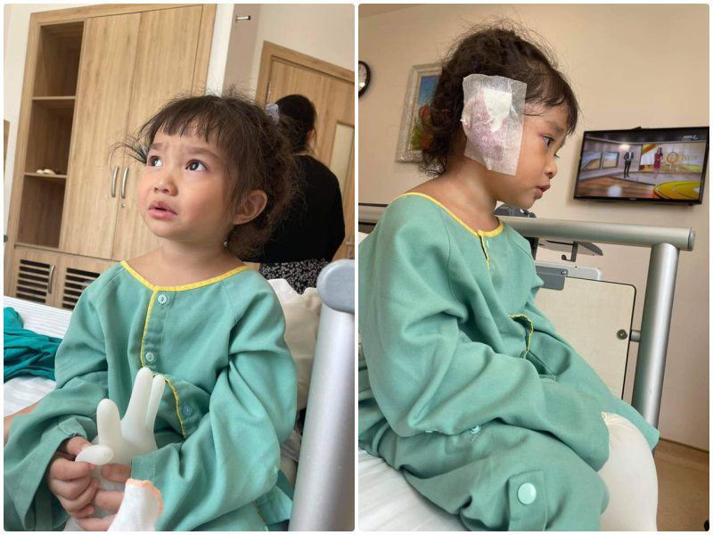 Con gái Lê Dương Bảo Lâm 3 tuổi làm phẫu thuật bệnh 100 người mới có 1 người mắc - 5