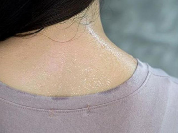 Đột xuất đổ mồ hôi đêm, triệu chứng của ít nhất 6 loại ung thư ai cũng nên biết rõ