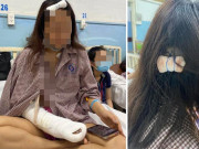 Tin tức - 4 cô gái bị đánh đập vì mời bia không uống: Nạn nhân đứt gân tay, chằng chịt vết thương