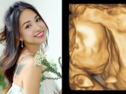 Bà bầu - Đăng ảnh siêu âm con, nữ DV "Nhật ký Vàng Anh" tiết lộ hành động lạ của bé