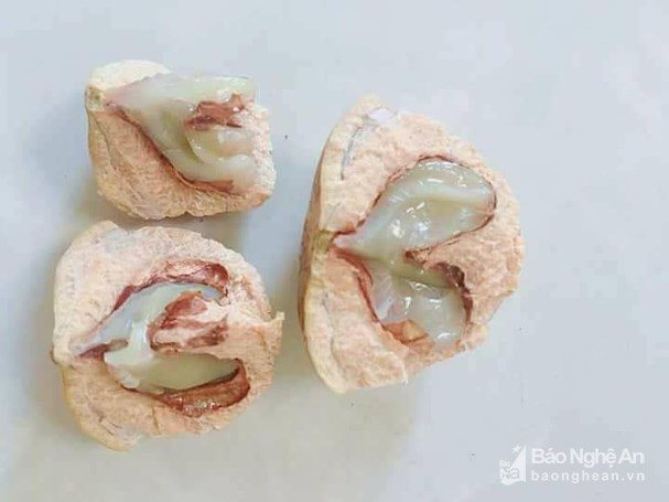 Quả dại không ai nhòm ngó giờ thành đặc sản chỉ có ở Nghệ An, đắt khách như tôm tươi - 4