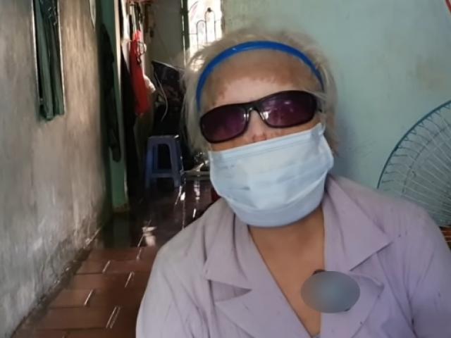 Người phụ nữ bị tiểu tam cướp chồng, tạt axit khiến đôi mắt mù vĩnh viễn, khuôn mặt biến dạng