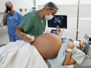 Tin tức - Mang thai 5 tự nhiên 60 triệu ca có một, ngày sinh mẹ đi ngược dự kiến của bác sĩ