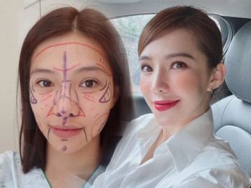 Lưu Đê Ly đánh đổi vẻ đẹp tự nhiên thành nhân tạo, kết quả như thế này đây