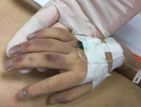 Hình ảnh bé gái 6 tuổi nghi bị bạo hành tới tử vong tại Hà Nội (ảnh TL)