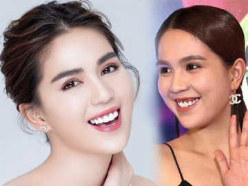 Đẹp lên nhờ răng sứ nhưng Ngọc Trinh lại có "hố đen" mất thẩm mỹ ở chân răng