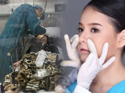 Làm đẹp - Đi nâng mũi đón Tết, cô gái Hà Nội hôn mê 3 ngày chưa tỉnh, bác sĩ cảnh báo