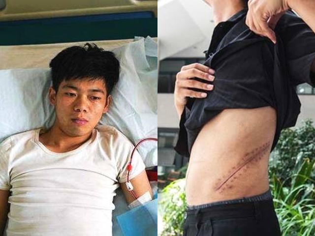 Chàng trai 17 tuổi bán thận mua iPhone 10 năm trước giờ ra sao?