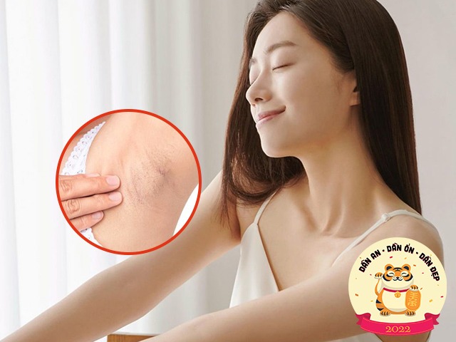 Tẩy lông tại nhà xinh tươi đón Tết, nàng nên lưu 7 ghi nhớ này để lông không cứng thêm