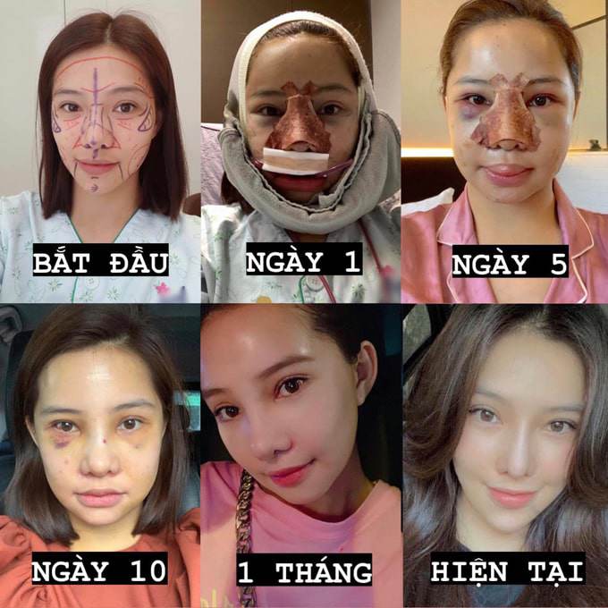 Sau 6 ca trùng tu, nhan sắc Lưu Đê Ly amp;#34;lên đờiamp;#34; nhưng body rực lửa mới đáng bàn - 5