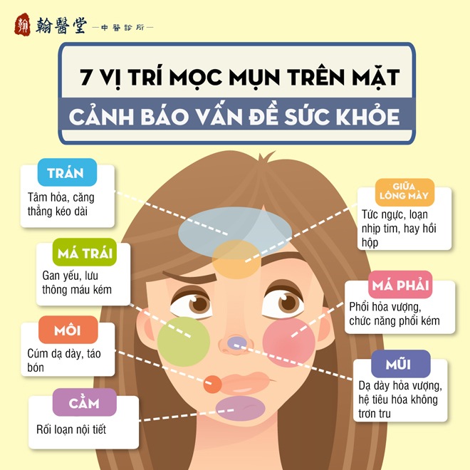 7 vị trí mọc mụn trên mặt cảnh báo gan yếu, phổi kém, tiêu hóa không trơn tru - 2