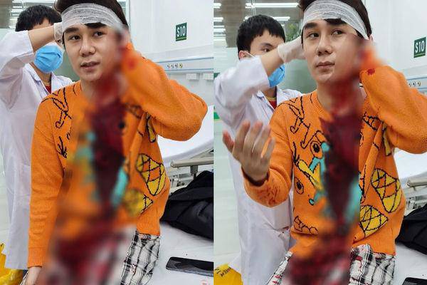 Diễn viên Ngô Sỹ Lâm nhập viện điều trị.