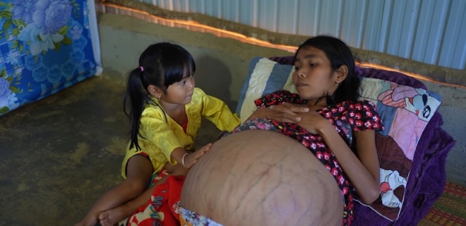 Chiếc bụng của Ka Sim ngày càng to.