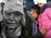 Tin tức - Nữ giáo viên mặt đầy máu, bố khóc tạm biệt con trước khi ly tán trong cuộc xung đột Nga-Ukraine