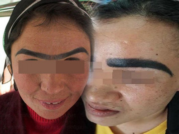 Điêu khắc chân mày: Con dao hai lưỡi có thể làm vẻ đẹp của bạn tan biến