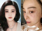 Giải trí - Đăng ảnh mặt dị ứng ban đỏ, Phạm Băng Băng bất ngờ nhận chỉ trích, lý do gây sốt