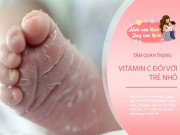 Làm mẹ - Dấu hiệu trẻ thiếu vitamin C và 10 thực phẩm nhiều vitamin C theo bác sĩ BV Nhi đồng II