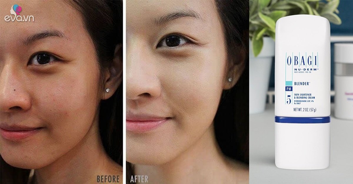 Pros and cons of hot skin whitening creams, some from only 279k
