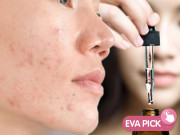 Làm đẹp - Dùng vitamin C trị thâm: da thêm mụn, không đều màu là do bạn chưa hiểu rõ serum mình dùng