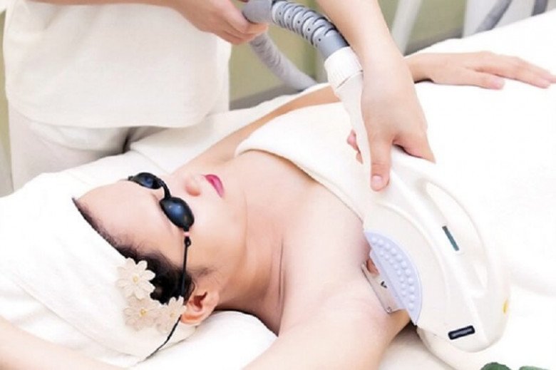Armpit hair removal, a life-saving cosmetic procedure for women on a hot summer day - 3