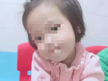 Bé gái 3 tuổi bị người tình của mẹ đóng 9 chiếc đinh vào đầu đã tử vong