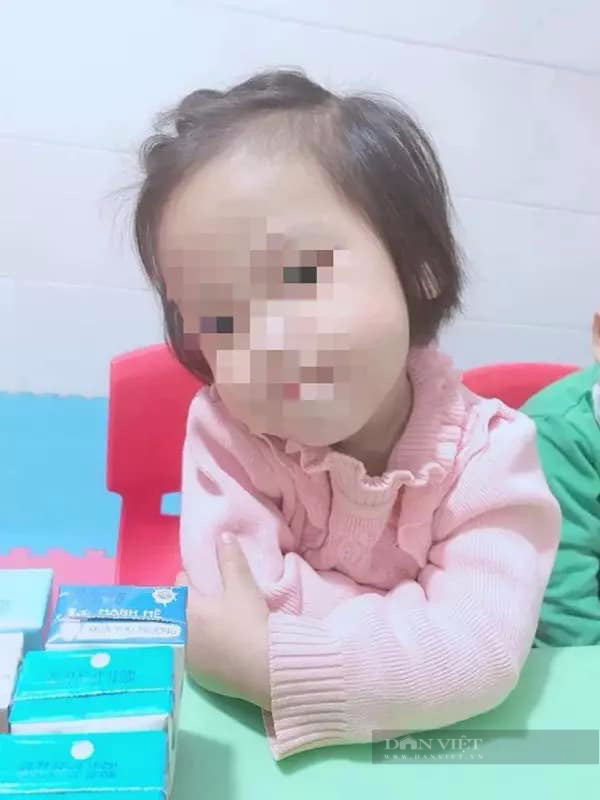 3-year-old mother dies with nails in her head: amp;#34;I regret not knowing how to protect my child...amp;#34;  - 3