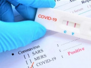 Sức khỏe - Tái mắc COVID-19 tới 3 lần liệu sức khỏe có bị ảnh hưởng nghiêm trọng?