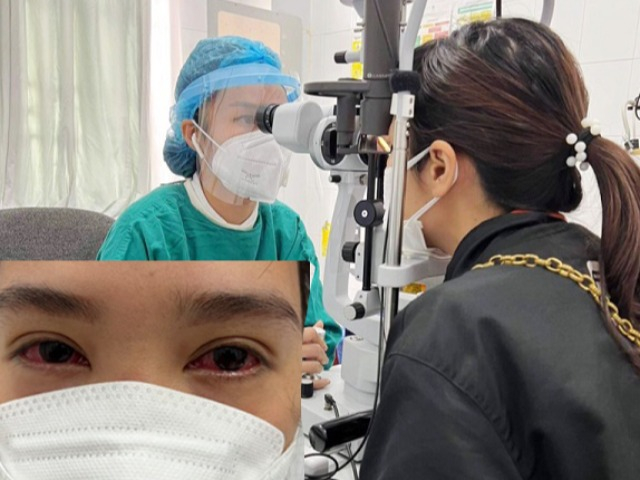 Người phụ nữ mắt đỏ rực do hậu COVID-19, bác sĩ khuyên bỏ ngay thói quen khi là F0