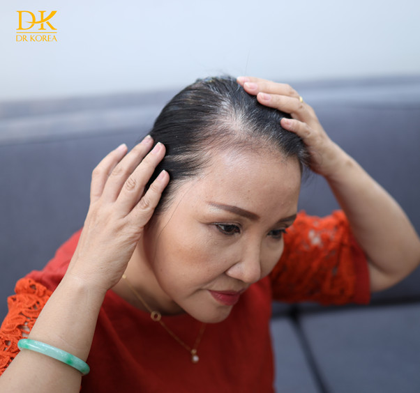 Actress Ngan Quynh rises like a kite in the wind after hair loss treatment at Dr Korea - 2