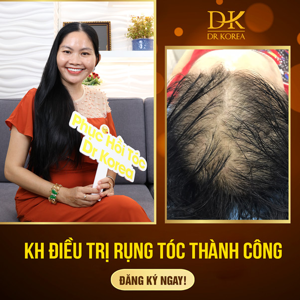 Actress Ngan Quynh rises like a kite in the wind after hair loss treatment at Dr Korea - 5