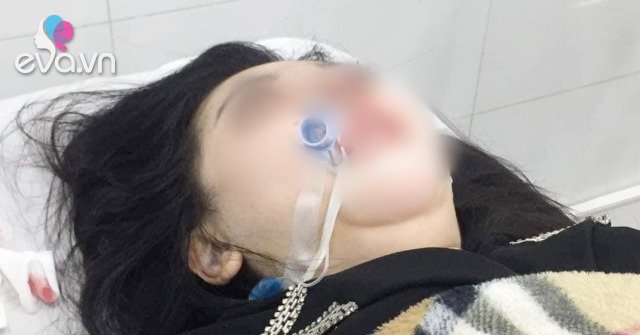 Rhinoplasty surgery at a cosmetic facility, 22 year old girl dies after 2 months in a coma