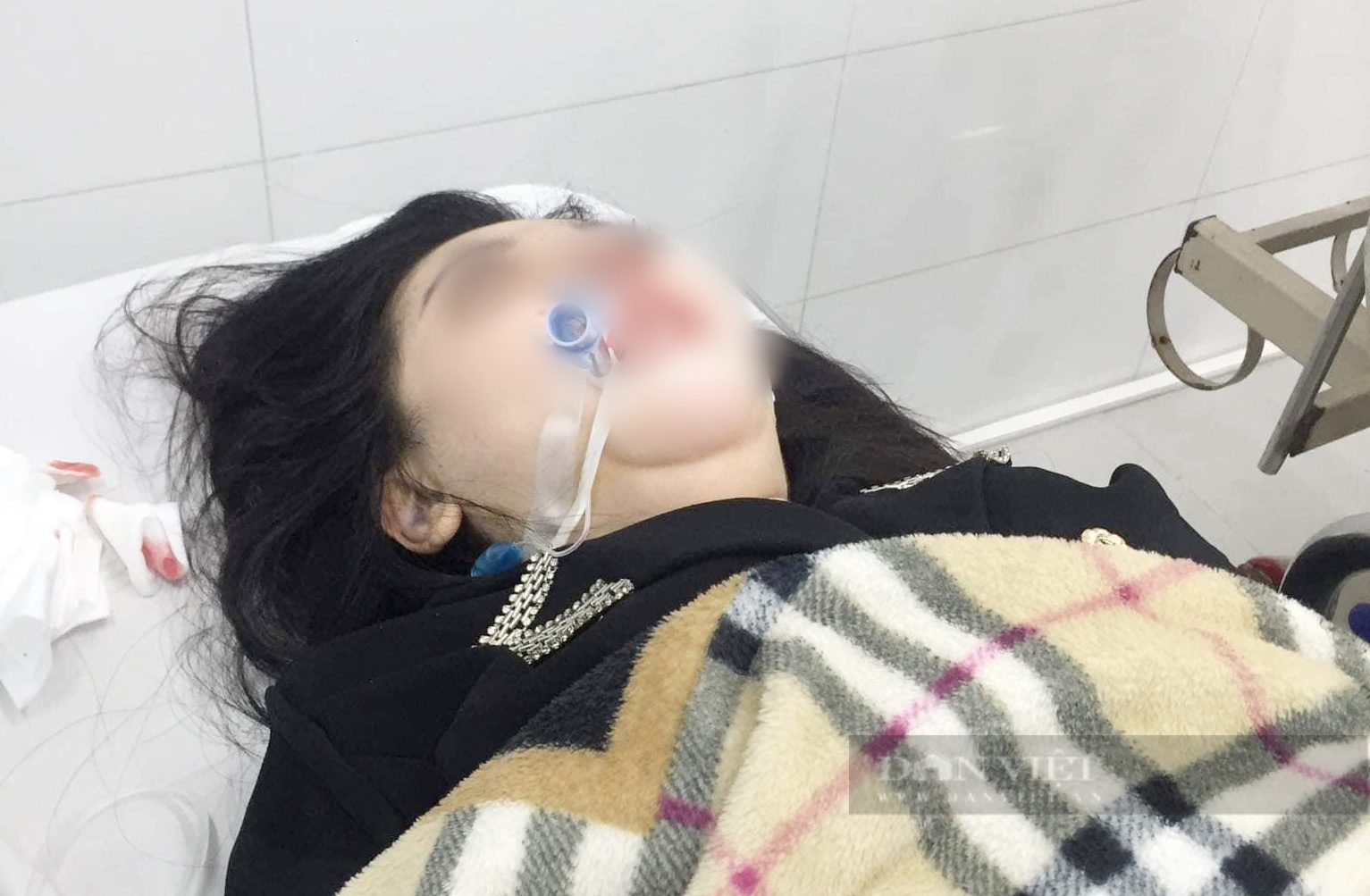 Rhinoplasty in cosmetic facility, 22 year old girl dies after 2 months in coma - 1