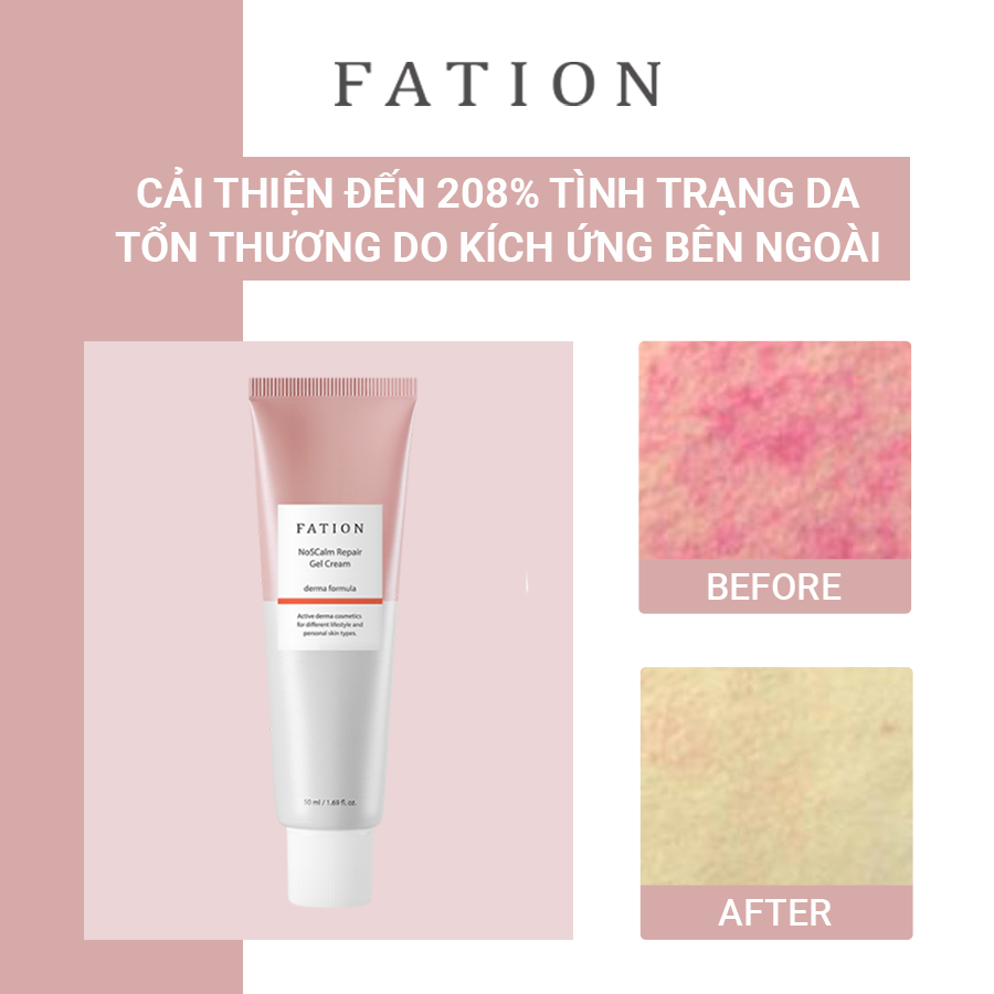 Set of 4 products to support skin recovery FATION brand - 7