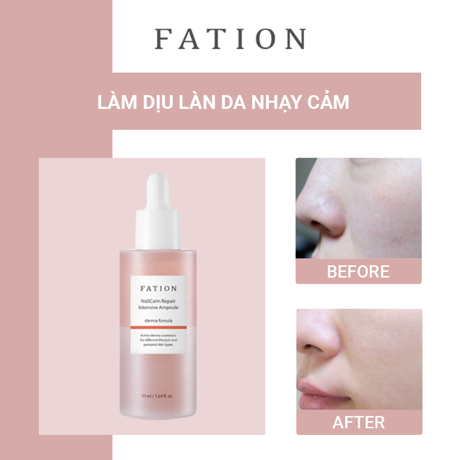 Set of 4 products to support skin recovery FATION brand - 5