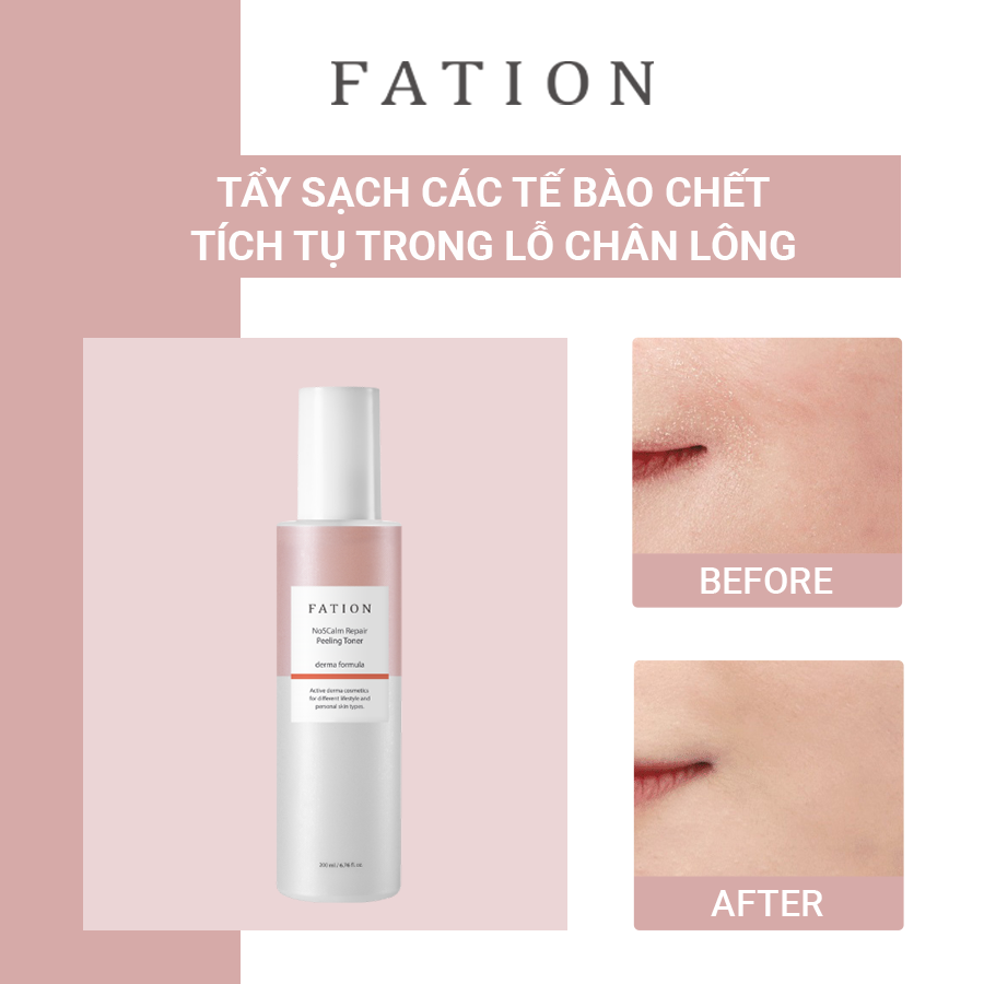 Set of 4 products to support skin recovery FATION brand - 3