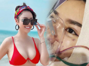 Làm đẹp - Quế Vân: Đập mặt làm lại, sở hữu số lần dao kéo kỷ lục vẫn chưa hài lòng