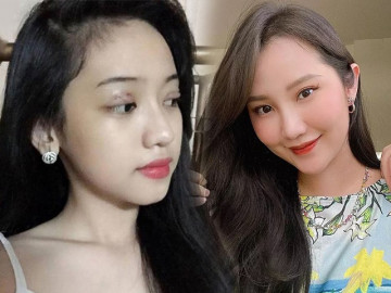 Không sa đà sửa sang như hot girl Cà Mau, vợ Phan Thành tút nhẹ đôi mắt đủ toả sáng