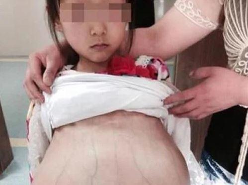 11-year-old girl gave birth in the middle of the night, knowing the identity of the person accompanying the doctor was stunned - 3