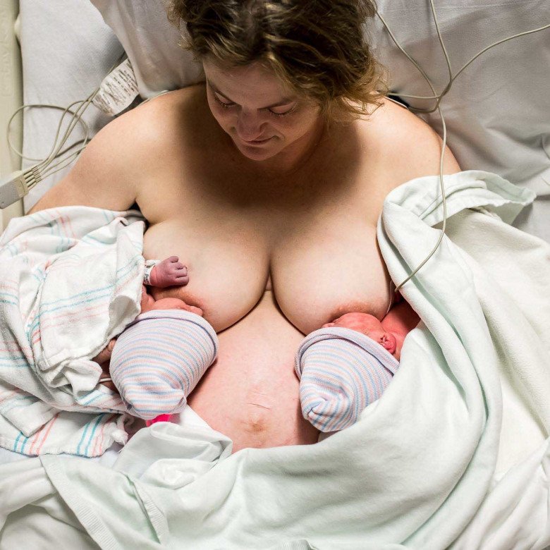 Sau khi trải qua một ca sinh mổ khẩn cấp, người mẹ giờ đây có thể yên bình, hạnh phúc ngắm nhìn 2 đứa con đáng yêu, xinh xắn.