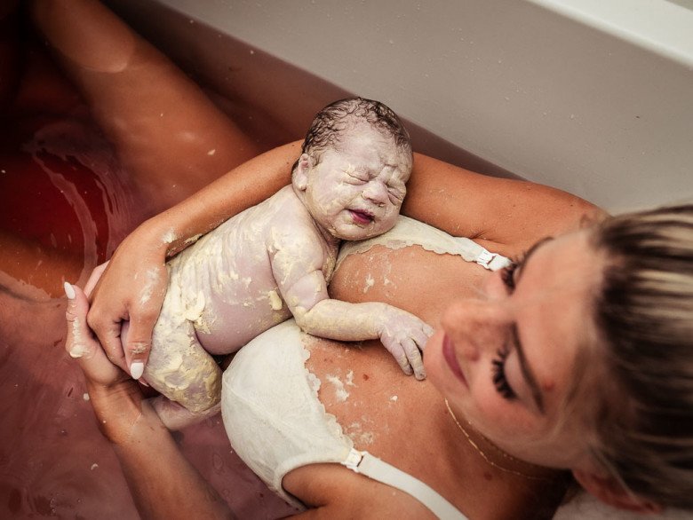 Khoảnh khắc chào đời ấn tượng của những em bé với lớp sáp trắng đáng giá hơn vàng
